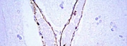 Primary Antibodies for Western Blotting