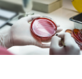 Microbiology Results for Critical Patients: A 2023 Perspective Microbiology Results for Critical Patients: A 2023 Perspective